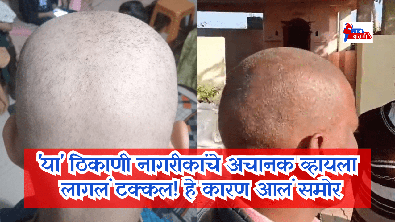 Buldhana hair fall news